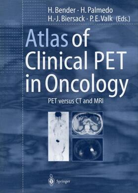 Bender / Valk / Palmedo |  Atlas of Clinical PET in Oncology | Buch |  Sack Fachmedien