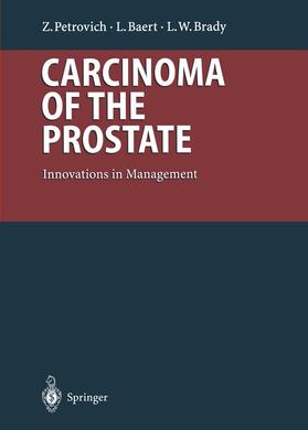 Petrovich / Baert / Brady |  Carcinoma of the Prostate | Buch |  Sack Fachmedien
