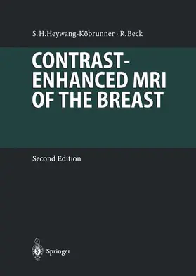 Beck / Heywang-Köbrunner |  Contrast-Enhanced MRI of the Breast | Buch |  Sack Fachmedien