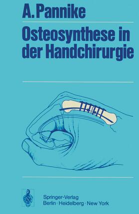 Pannike |  Osteosynthese in der Handchirurgie | Buch |  Sack Fachmedien