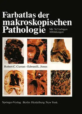 Curran / Jones |  Farbatlas der makroskopischen Pathologie | eBook | Sack Fachmedien