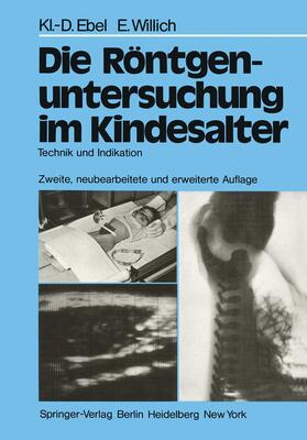 Ebel / Willich |  Die Röntgenuntersuchung im Kindesalter | Buch |  Sack Fachmedien