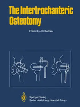 Schatzker |  The Intertrochanteric Osteotomy | eBook | Sack Fachmedien