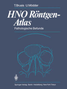 Brusis / Mödder |  HNO Röntgen-Atlas | eBook | Sack Fachmedien