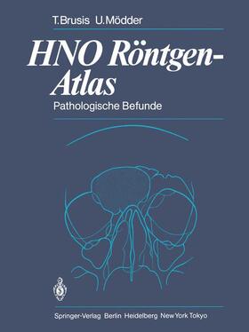 Brusis / Mödder |  HNO Röntgen-Atlas | Buch |  Sack Fachmedien