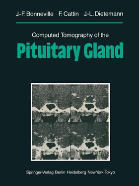 Cattin / Bonneville / Dietemann |  Computed Tomography of the Pituitary Gland | Buch |  Sack Fachmedien