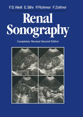 Weill / Zeltner / Bihr |  Renal Sonography | Buch |  Sack Fachmedien