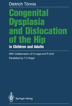 Tönnis |  Congenital Dysplasia and Dislocation of the Hip in Children and Adults | eBook | Sack Fachmedien