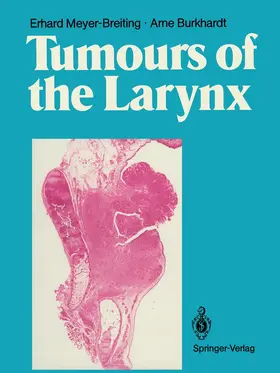 Burkhardt / Meyer-Breiting | Tumours of the Larynx | Buch | 978-3-642-71102-2 | sack.de