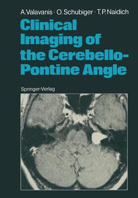 Valavanis / Naidich / Schubiger |  Clinical Imaging of the Cerebello-Pontine Angle | Buch |  Sack Fachmedien