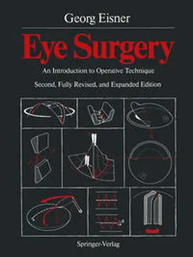 Eisner |  Eye Surgery | eBook | Sack Fachmedien