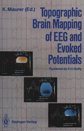 Maurer |  Topographic Brain Mapping of EEG and Evoked Potentials | Buch |  Sack Fachmedien