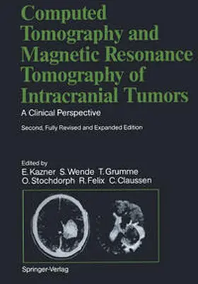 Felix / Kazner / Grumme |  Computed Tomography and Magnetic Resonance Tomography of Intracranial Tumors | eBook | Sack Fachmedien