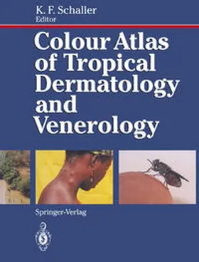 Schaller |  Colour Atlas of Tropical Dermatology and Venerology | eBook | Sack Fachmedien