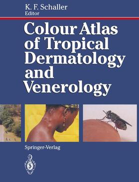 Schaller |  Colour Atlas of Tropical Dermatology and Venerology | Buch |  Sack Fachmedien