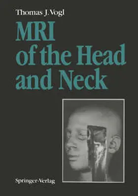 Vogl |  MRI of the Head and Neck | eBook | Sack Fachmedien