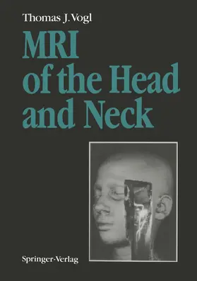 Vogl |  MRI of the Head and Neck | Buch |  Sack Fachmedien