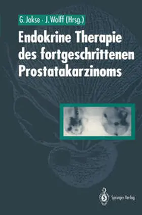 Jakse / Wolff |  Endokrine Therapie des fortgeschrittenen Prostatakarzinoms | eBook | Sack Fachmedien