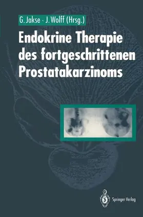 Wolff / Jakse |  Endokrine Therapie des fortgeschrittenen Prostatakarzinoms | Buch |  Sack Fachmedien