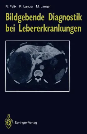 Felix / Langer |  Bildgebende Diagnostik bei Lebererkrankungen | Buch |  Sack Fachmedien