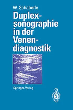 Schäberle |  Duplexsonographie in der Venendiagnostik | eBook | Sack Fachmedien