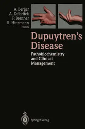 Berger / Delbrück / Brenner |  Dupuytren’s Disease | eBook | Sack Fachmedien