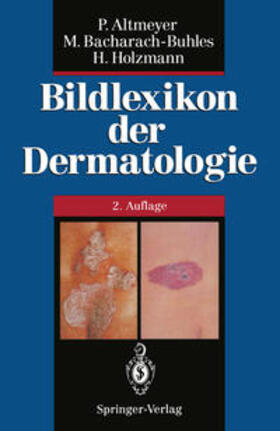 Altmeyer / Bacharach-Buhles / Holzmann |  Bildlexikon der Dermatologie | eBook | Sack Fachmedien