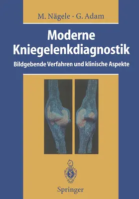 Nägele / Adam |  Moderne Kniegelenkdiagnostik | Buch |  Sack Fachmedien