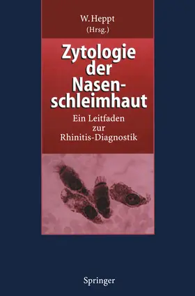 Heppt |  Zytologie der Nasenschleimhaut | Buch |  Sack Fachmedien