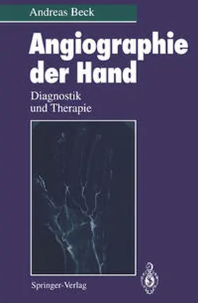 Beck |  Angiographie der Hand | eBook | Sack Fachmedien