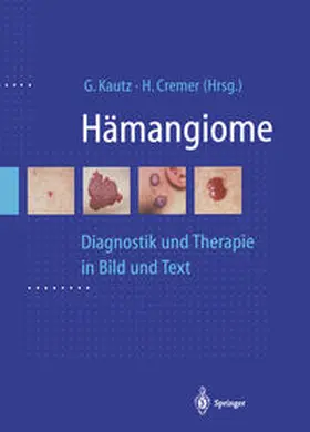 Kautz / Cremer |  Hämangiome | eBook | Sack Fachmedien