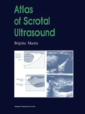 Martin |  Atlas of Scrotal Ultrasound | Buch |  Sack Fachmedien