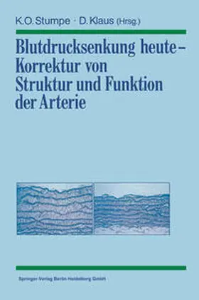 Stumpe / Klaus |  Blutdrucksenkung heute — Korrektur von Struktur und Funktion der Arterie | eBook | Sack Fachmedien