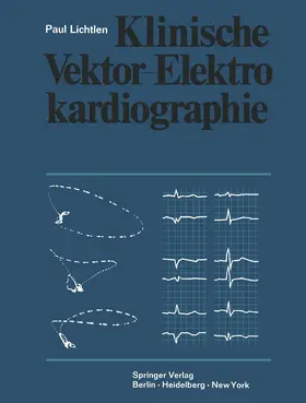 Lichtlen | Klinische Vektor-Elektrokardiographie | Buch | 978-3-642-87201-3 | sack.de