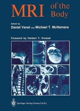 Vanel / McNamara |  MRI of the Body | Buch |  Sack Fachmedien
