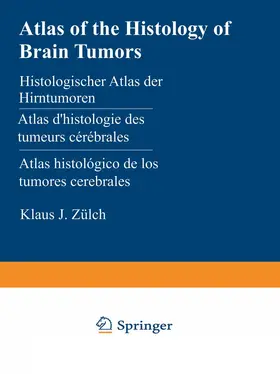 Zülch |  Atlas of the Histology of Brain Tumors | Buch |  Sack Fachmedien