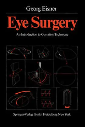 Eisner |  Eye Surgery | eBook | Sack Fachmedien