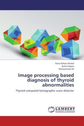 Khalid / Haque / Ali |  Image processing based diagnosis of thyroid abnormalities | Buch |  Sack Fachmedien