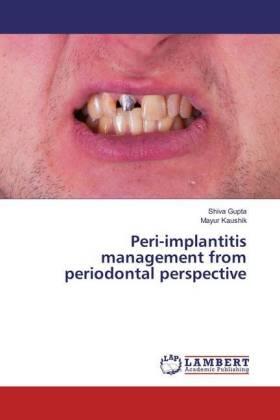 Gupta / Kaushik |  Peri-implantitis management from periodontal perspective | Buch |  Sack Fachmedien