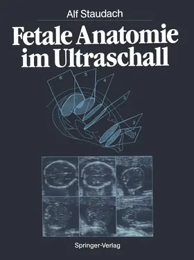 Staudach |  Fetale Anatomie im Ultraschall | Buch |  Sack Fachmedien