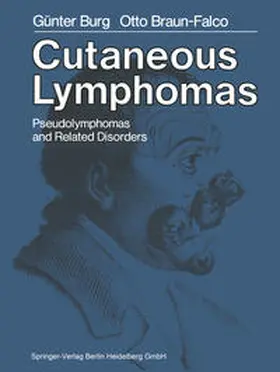 Burg / Braun-Falco |  Cutaneous Lymphomas, Pseudolymphomas, and Related Disorders | eBook | Sack Fachmedien