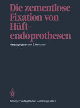 Morscher |  Die zementlose Fixation von Hüftendoprothesen | eBook | Sack Fachmedien