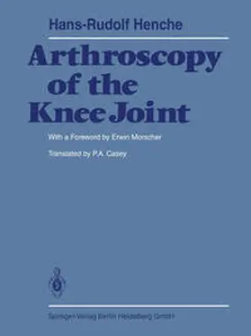 Henche |  Arthroscopy of the Knee Joint | eBook | Sack Fachmedien