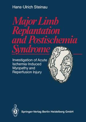 Steinau |  Major Limb Replantation and Postischemia Syndrome | Buch |  Sack Fachmedien