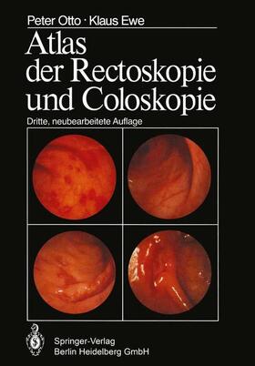 Ewe / Otto |  Atlas der Rectoskopie und Coloskopie | Buch |  Sack Fachmedien