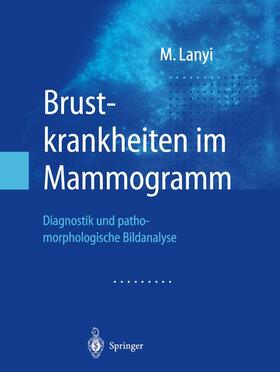 Lanyi |  Brustkrankheiten im Mammogramm | Buch |  Sack Fachmedien