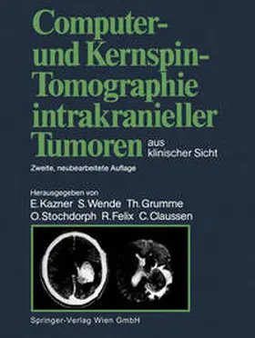 Kazner / Wende / Grumme |  Computer- und Kernspin-Tomographie intrakranieller Tumoren aus klinischer Sicht | eBook | Sack Fachmedien