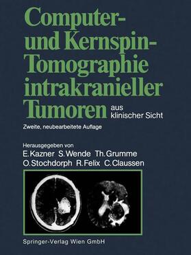 Kazner / Wende / Grumme |  Computer- und Kernspin-Tomographie intrakranieller Tumoren aus klinischer Sicht | Buch |  Sack Fachmedien