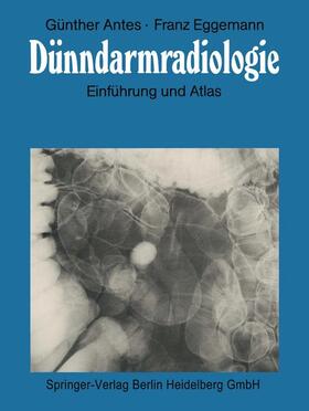Antes / Eggemann |  Dünndarmradiologie | Buch |  Sack Fachmedien