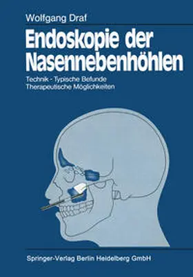 Draf |  Endoskopie der Nasennebenhöhlen | eBook | Sack Fachmedien